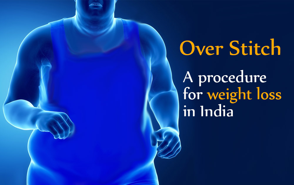weight-lose