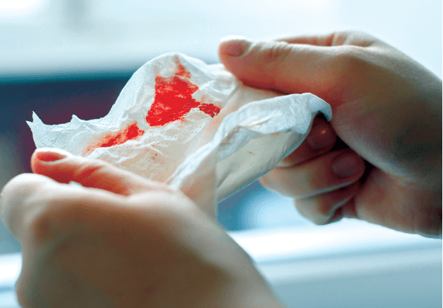 tuberculosis an ancient foe