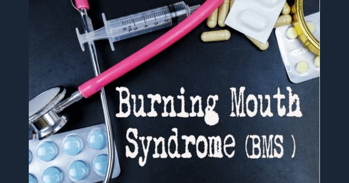 Burning mouth syndrome featured image for wordpress and facebook