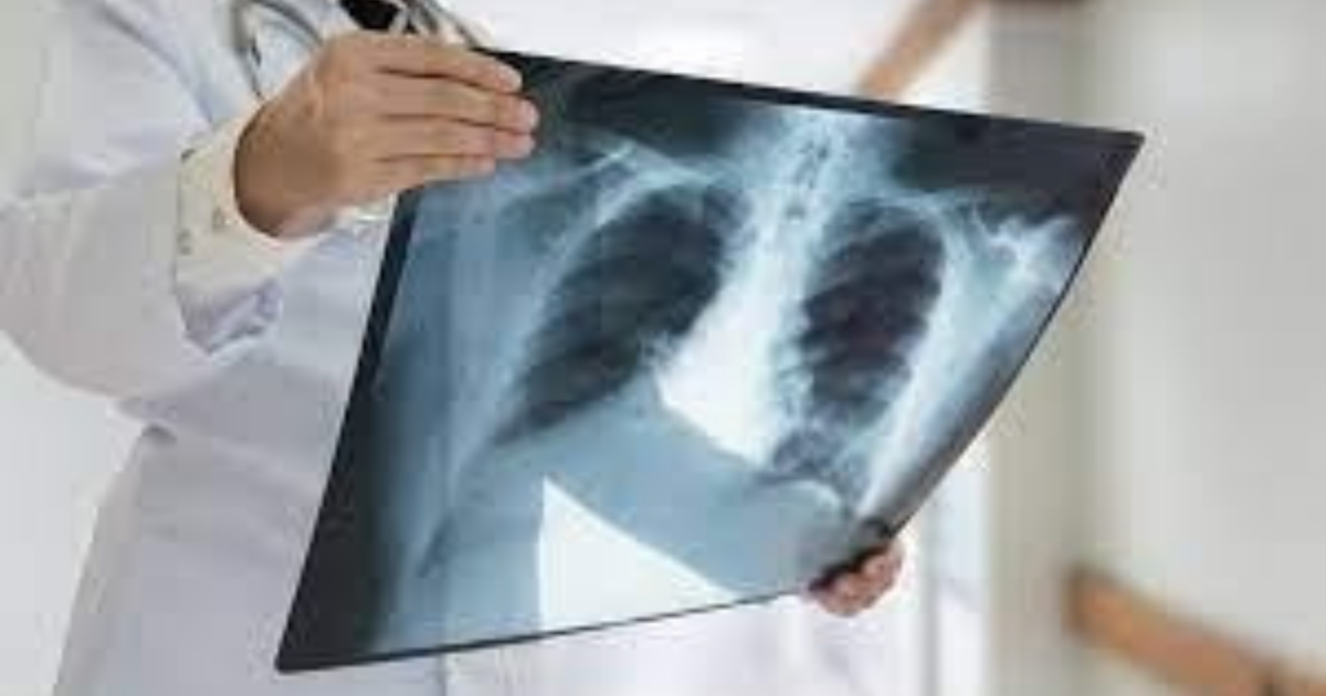 Artificial intelligence based tool to detect covid-19 from chest x-ray by IIT Gandhinagar