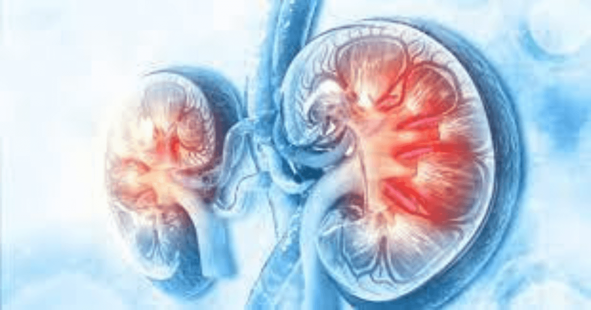 Kerendia For Diabetics With Chronic Kidney Disease_featured image
