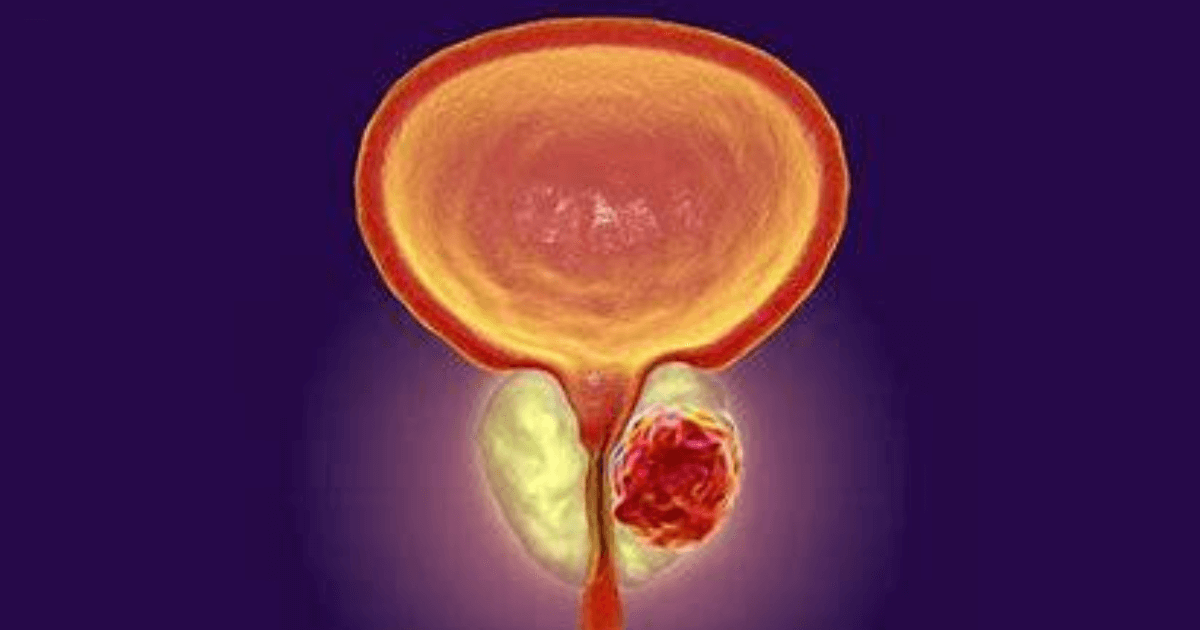 Psma-targeted Therapy_featured image
